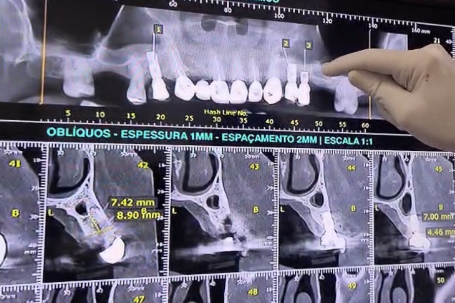 Discussão de casos 1